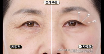 ลืมงานโบท็อกซ์ไปได้เลย Lifting Stick ปาดหน้า 3 ที รู้เรื่อง ตึงทันตา อุ๊ต๊ะ!!! lift-768x374